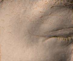 Skin condition around the eyes before wrinkle improvement